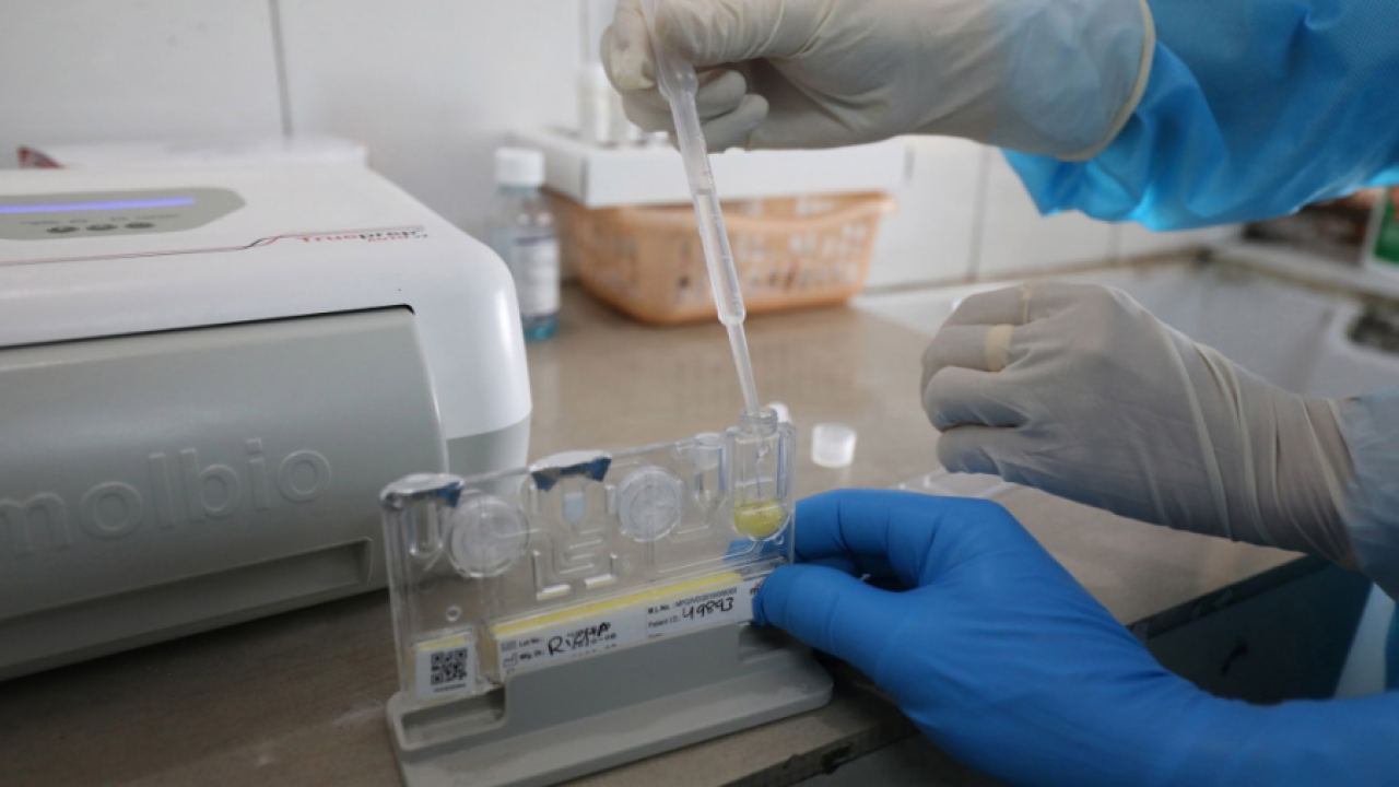 Приравняват антигенните тестове с PCR за Covid диагностика