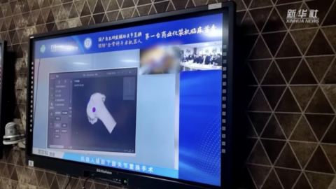 Произведен в Китай робот направи първа операция за смяна на колянна става