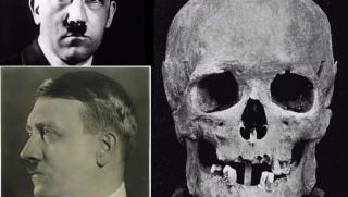 Daily Telegraph, Френски учени, зъби, Хитлер, умрял