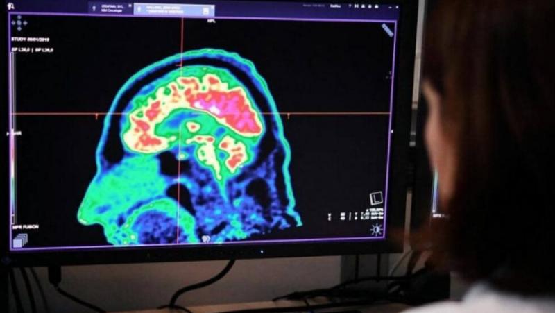 Някои сред 1000-те американски дипломати и служители на разузнаването, засегнати